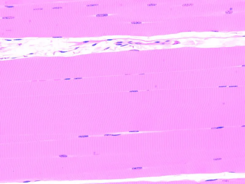 The significant difference between skeletal muscle and cardiac muscle indicates that the skeletal muscle is under voluntary command while the cardiac muscle is under spontaneous command. Muscle tissue is among the four tissues available in the animal body. It possesses the capacity to contract to stimulate the motions of various regions of the body. Therefore, muscle tissue is described as contractile tissue. It emanates from the mesoderm coating of the embryonic germ cell. Concerning the roles, three significant kinds of muscle tissues have to do with cardiac muscle, skeletal muscle, and smooth muscle. Based on these three various kinds, smooth and cardiac muscles operate spontaneously as their contraction occurs without conscious thought. However, cardiac muscle is available in the heart tracts of vertebrates, whereas skeletal muscle stimulates body motions by controlling the bones with tendons.