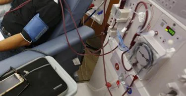 The significant difference between dialysis and kidney transplant shows that dialysis is a medical process to take out waste products and too much fluid from the blood when the kidneys do not operate adequately. Kidney transplant on the other hand is described as the organ transplant of a kidney into a patient that is experiencing the final phase of kidney ailment. Dialysis and kidney transplant are two medication procedures for kidney failure.
